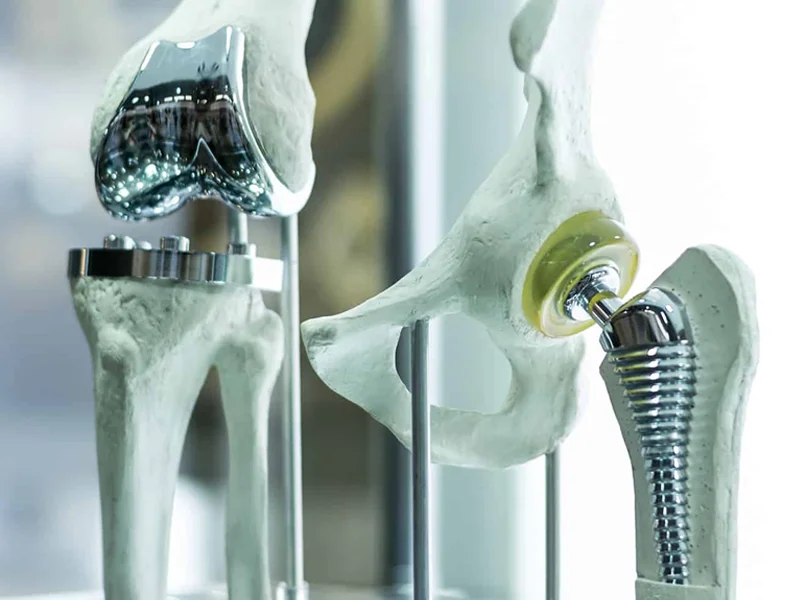 Orthopedic Trauma-1
