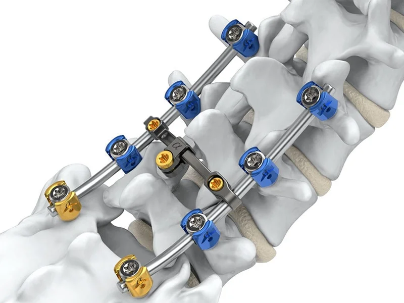 Spinal Applications-1